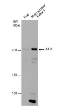 ATR Antibody (2B5), Novus Biologicals 0.1mL; Unlabeled:Antibodies, Monoclonal