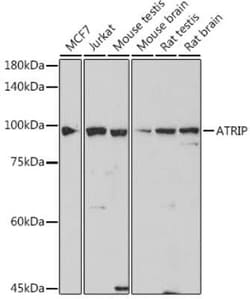 ATRIP Rabbit anti-Human, Mouse, Rat, Clone: 2C4B6, Novus Biologicals 20