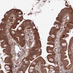 ATRNL1 Antibody, Novus Biologicals:Antibodies:Primary Antibodies
