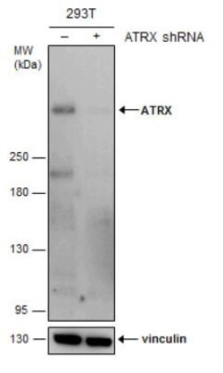 ATRX Antibody (4212), Novus Biologicals 0.1mL; Unlabeled:Antibodies, Monoclonal