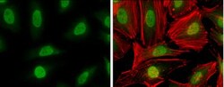 ATRX Antibody, Novus Biologicals 0.1mL; Unlabeled:Antibodies, Polyclonal