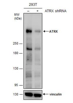 ATRX Antibody, Novus Biologicals 0.1mL; Unlabeled:Antibodies, Polyclonal