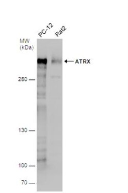 ATRX Antibody, Novus Biologicals 0.1mL; Unlabeled:Antibodies, Polyclonal
