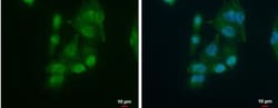 AUF1 Antibody, Novus Biologicals 0.1mL; Unlabeled:Antibodies, Polyclonal