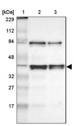 AUF1 Antibody, Novus Biologicals:Antibodies:Primary Antibodies