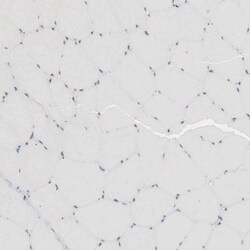 AUTS2 Antibody, Novus Biologicals 25ul | Buy Online | Novus Biologicals | Fisher Scientific