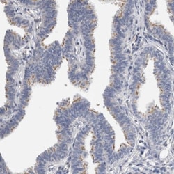 AZ1 Antibody, Novus Biologicals 0.1mL; Unlabeled:Antibodies, Polyclonal