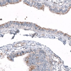 AZ1 Antibody, Novus Biologicals 0.1mL; Unlabeled:Antibodies, Polyclonal