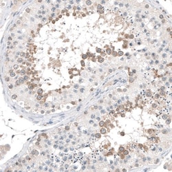 AZ1 Antibody, Novus Biologicals 0.1mL; Unlabeled:Antibodies, Polyclonal