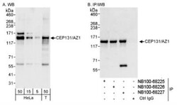 AZ1 Antibody, Novus Biologicals 0.1mL; Unlabeled:Antibodies, Polyclonal