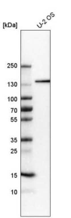 AZ1 Antibody, Novus Biologicals 0.1mL; Unlabeled:Antibodies, Polyclonal