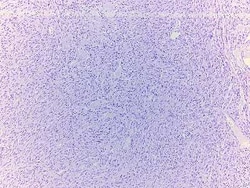 Novus Biologicals Abdominal Tissue Slides (Malignant Mesothelioma)- Paraffin 5 Slides | Buy Online | Novus Biologicals&trade; | Fisher Scientific