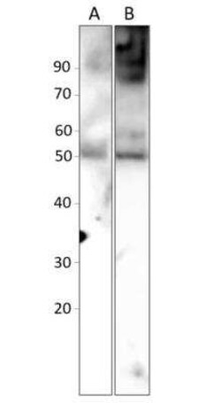 Abraxas Antibody, Novus Biologicals 100 &mu;g | Buy Online | Bio-Techne | Fisher Scientific
