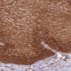 Absent in melanoma 1 Antibody, Novus Biologicals:Antibodies:Primary Antibodies