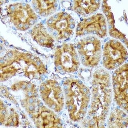 Acetyl-CoA Carboxylase alpha/ACACA Rabbit anti-Human, Mouse, Rat, Clone: