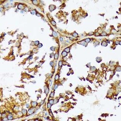 Acetyl-CoA Carboxylase alpha/ACACA Rabbit anti-Human, Mouse, Rat, Clone: