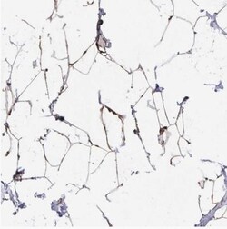 Acetyl-CoA Carboxylase alpha/ACACA Antibody, Novus Biologicals 0.1mL; Unlabeled:Antibodies,