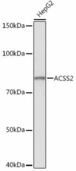 Acetyl CoA synthetase Rabbit anti-Human, Mouse, Rat, Clone: 4N5V4, Novus