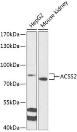 Acetyl CoA synthetase Rabbit anti-Human, Mouse, Rat, Polyclonal, Novus