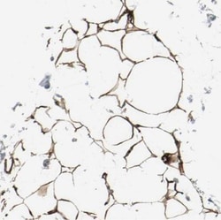 Acetyl Coenzyme A Carboxylase Beta Antibody, Novus Biologicals 0.1mL; Unlabeled:Antibodies,