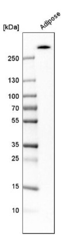 Acetyl Coenzyme A Carboxylase Beta Antibody, Novus Biologicals 0.1mL; Unlabeled:Antibodies,