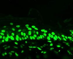 Acetyl-Lysine Antibody (7F8), Novus Biologicals 0.1mg; Unlabeled:Antibodies,