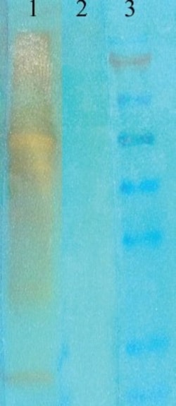 Acetyl-Lysine Antibody (7F8), Novus Biologicals 0.1mg; Unlabeled:Antibodies,