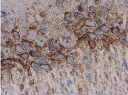 Acetylcholinesterase/ACHE Antibody, Novus Biologicals 0.1mg; Unlabeled:Antibodies,