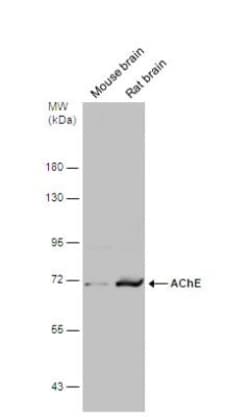 Acetylcholinesterase/ACHE Antibody, Novus Biologicals 0.1mg; Unlabeled:Antibodies,