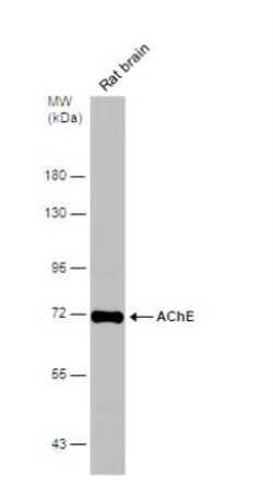 Acetylcholinesterase/ACHE Antibody, Novus Biologicals 0.1mg; Unlabeled:Antibodies,