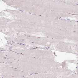 Acidic Calponin Antibody, Novus Biologicals 0.1mL; Unlabeled:Antibodies,