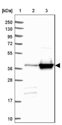 Acidic Calponin Antibody, Novus Biologicals 0.1mL; Unlabeled:Antibodies,