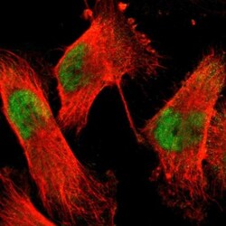 Acinus Antibody, Novus Biologicals 0.1mL; Unlabeled:Antibodies, Polyclonal
