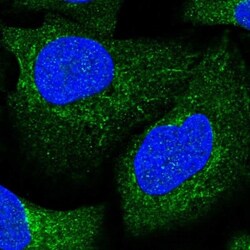 Aconitase 1 Antibody, Novus Biologicals 0.1mL; Unlabeled:Antibodies, Polyclonal
