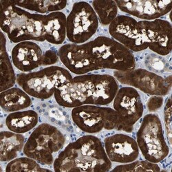 Aconitase 1 Antibody, Novus Biologicals 0.1mL; Unlabeled:Antibodies, Polyclonal