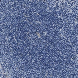 Aconitase 1 Antibody, Novus Biologicals 0.1mL; Unlabeled:Antibodies, Polyclonal