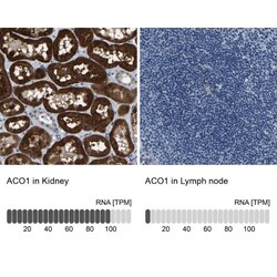 Aconitase 1 Antibody, Novus Biologicals 0.1mL; Unlabeled:Antibodies, Polyclonal