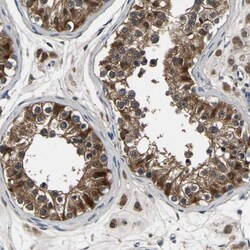 Aconitase 1 Antibody, Novus Biologicals 0.1mL; Unlabeled:Antibodies, Polyclonal