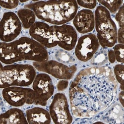 Aconitase 1 Antibody, Novus Biologicals 0.1mL; Unlabeled:Antibodies, Polyclonal