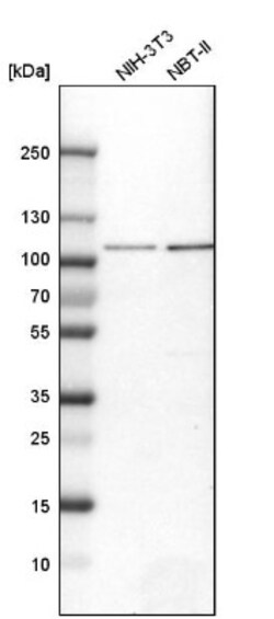 Aconitase 1 Antibody, Novus Biologicals 0.1mL; Unlabeled:Antibodies, Polyclonal