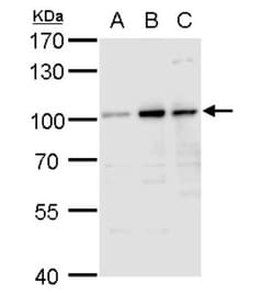 Aconitase 1 Antibody, Novus Biologicals 0.1mL; Unlabeled:Antibodies, Polyclonal