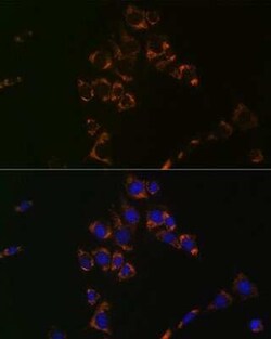 Aconitase 2 Rabbit anti-Human, Mouse, Rat, Clone: 0P3H3, Novus Biologicals