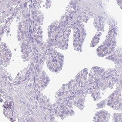 Acrosin Antibody, Novus Biologicals 25ul | Buy Online | Novus Biologicals | Fisher Scientific