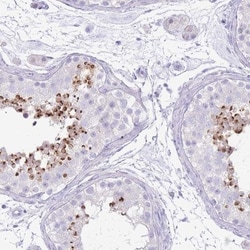 Acrosin Antibody, Novus Biologicals 25ul | Buy Online | Novus Biologicals | Fisher Scientific