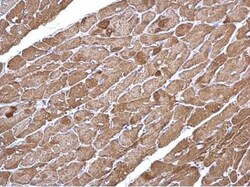 Actin Alpha 1 Cardiac Muscle Antibody, Novus Biologicals 0.1mL; Unlabeled:Antibodies,