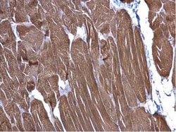 Actin Alpha 1 Cardiac Muscle Antibody, Novus Biologicals 0.1mL; Unlabeled:Antibodies,