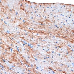 Actin Rabbit anti-Human, Mouse, Rat, Clone: 3U6B8, Novus Biologicals 100 &mu;g | Buy Online | Novus Biologicals | Fisher Scientific