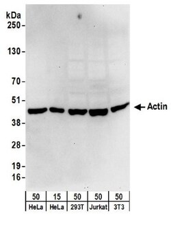 Actin Gamma 1 Antibody, Novus Biologicals 0.1mL; Unlabeled:Antibodies