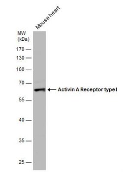 Activin RIA/ALK-2/Activin Receptor Type 1 Antibody, Novus Biologicals 0.1 mL | Buy Online | Novus Biologicals | Fisher Scientific
