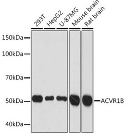 Activin RIB/ALK-4 Rabbit anti-Human, Mouse, Rat, Clone: 3U6I8, Novus Biologicals